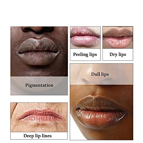 2pcs Lip Lightening for Dark Lips Lip Brightener for Smokers Dark Lip Treatment Lightening Cream for Pink Lips Lip Lightener for Smoker Lips Lip Lightening balm for Men and Women (Yellow)
