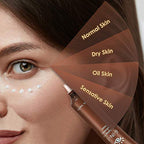 Anti Aging Eye Cream, Retinol Eye Cream Contains Niacinamide and Hyaluronic Acid, Reduces Wrinkles, Puffiness, Crows Feet and Dark Circles, 1 Oz