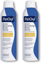 PanOxyl Acne Banishing Body Spray with 2% Salicylic Acid, Pimple Treatment to Clear Stubborn Breakouts, 360-Degree Spray Nozzle, Skin-Brightening Niacinamide, Vitamin C, Witch Hazel, Aloe, 6 Oz