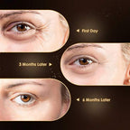 Anti Aging Eye Cream, Retinol Eye Cream Contains Niacinamide and Hyaluronic Acid, Reduces Wrinkles, Puffiness, Crows Feet and Dark Circles, 1 Oz