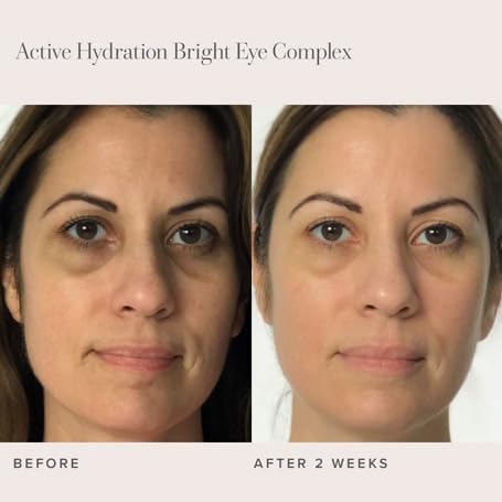 RODAN + FIELDS Active Hydration Bright Eye Complex | 15ml | Moisturizing Under Eye Cream for Dry Skin | Brightening Eye Treatment | Skincare