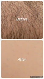 ARABESKS Dermaplaning Tool, 3ct | Dermaplane, Face Razors for Women, Eyebrow Razor, Facial Razor, Dermaplaning Razor, Womens Face Razor Peach Fuzz Remover, Eyebrow Trimmer