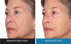 Serious Skincare INSTA-TOX Facial Firming Wrinkle Smoothing Serum and Reverse Lift Firming Eye Cream Set - Filler for Fine Lines, Deep Wrinkles and Pores - Temporary Eye Tightener