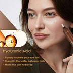 Anti Aging Eye Cream, Retinol Eye Cream Contains Niacinamide and Hyaluronic Acid, Reduces Wrinkles, Puffiness, Crows Feet and Dark Circles, 1 Oz