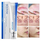 Advanced Scar Cream Gel, Scar Removal
