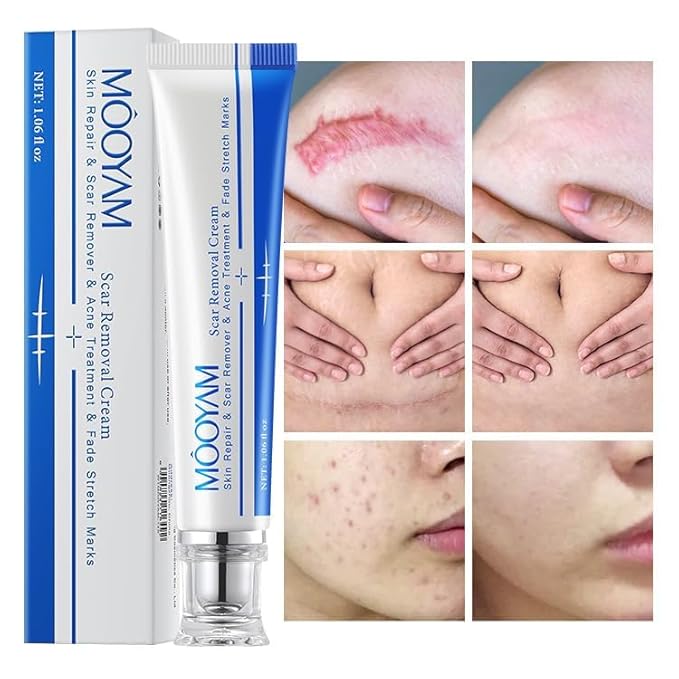 Advanced Scar Cream Gel, Scar Removal