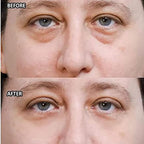 Wow-IT Instant Under Eye Cream,Ream For Eye Bags,Remove Under Eye Bags Instantly,Anti-Wrinkle Eye Cream，Helps To Instantly Reduce The Puffy Eye Look (3PCS)