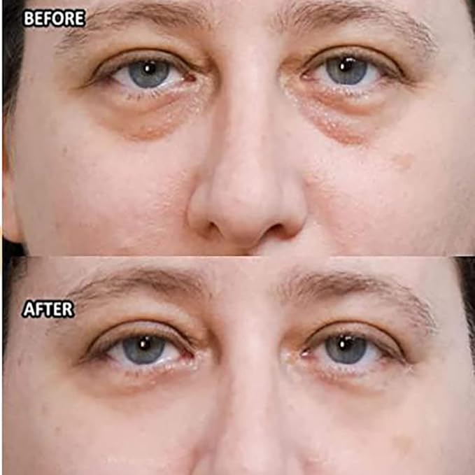 Wow-IT Instant Under Eye Cream,Ream For Eye Bags,Remove Under Eye Bags Instantly,Anti-Wrinkle Eye Cream，Helps To Instantly Reduce The Puffy Eye Look (3PCS)