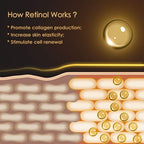 Anti Aging Eye Cream, Retinol Eye Cream Contains Niacinamide and Hyaluronic Acid, Reduces Wrinkles, Puffiness, Crows Feet and Dark Circles, 1 Oz