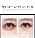 Under Eye Patches（23 Pairs）,Eye Mask Skincare For Puffiness,Eye Patches For Puffy Eyes And Dark Circles,Eye Gel Pads,Eye Bags Treatment For Women (23 Pairs)