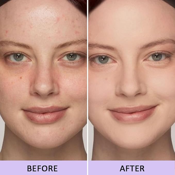 5 Colors Magic Touch Correcting Concealer Palette for 1 Count)