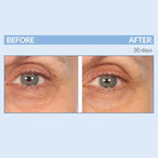 Serious Skincare - Eyetality PM Total Eye Care - Evening Night Eye Cream with Lash Boosting Peptides for Thicker, Longer Lashes - 0.5 oz.