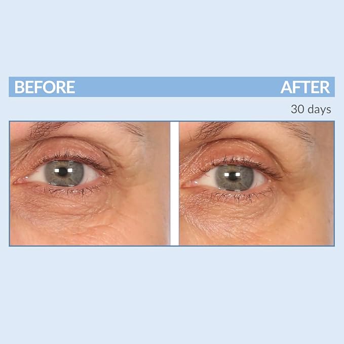 Serious Skincare - Eyetality Morning Total Eye Care Cream - For Lines, Wrinkles, Under Eye Puffiness and Dark Circles - Coffee Bean Extract - Vitamin C - Pomegranate - 0.5 oz