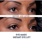 Eye Magic Premium Eye Lift (S/M Kit + Gel) Made in America Instantly Lifts and Defines Droopy, Sagging or Hooded Eyes Safe For Daily Use