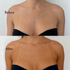 Self Tanner, All-Natural Gradual Self Tanning Lotion with Applicator Mitt, Luxurious Coconut Scent, Coconut Oil, Vitamin C, Hyaluronic Acid, Natural DHA