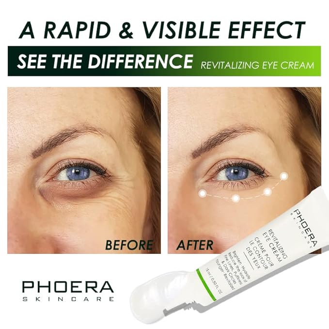 Phoera Revitalizing Eye Cream Brighten Hydrate Reduce The Fine Lines, Dark Circle Wrinkles And Puffiness For Men And Women Skin Loving Ingredients Apply In Morning And At Night