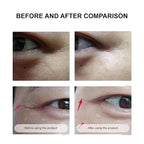 Under Eye Mask Wrinkle Patches, Under Eye Mask Amino Acid & Collagen,Eye Masks for Dark Circles and Puffiness,Eye Wrinkle Pads & Patches