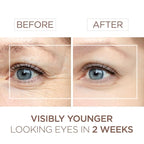 BEE and YOU Eye Cream, Anti Aging, Anti Wrinkle Serum 100% Natural with Bee Venom, Propolis Extract, Raw Honey, Hyaluronic Acid, For Dark Circles Under Eye Treatment and Puffiness, Skin Care, 15ml