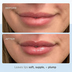 First Aid Beauty Ultra Repair Lip Balm – Instantly Hydrates to Leave Lips Soft, Supple + Plump – Concentrated Formula of Botanical Oils, Butters + Waxes – 0.25 oz