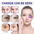 28 Pairs Under Eye Patches, Natural Collagen Eye Patches for Puffy Eyes, Under Eye Mask Patches for Face, Reduce Dark Circles, Fine Lines and Puffiness, Refreshes Your Skin, Eye Moisturizer Treatment