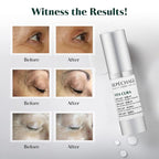Repechage Vita Cura Opti-Lift Serum - Anti Aging Eye Contour Lifting Effect to Smooth Out Look of Wrinkles and Crow's Feet with Almond Protein, Seaweed Extracts, and Peptides, 15ml /0.5fl oz.