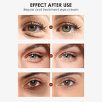 Eye Cream, STCORPS7 Vibrant Glamour Silk Protein Anti-Wrinkle And Firming Eye Cream For Wrinkles, Fine Lines, Dark Circles, Puffiness & Bags, 20g