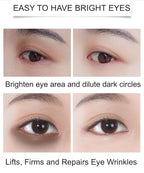 Under Eye Patches - 24K Gold Eye Mask,Moisturizing Serum for Firming, Brightening, and Relieving Eye Fatigue - Under Eye Patches for Dark Circles and Puffiness (gold)