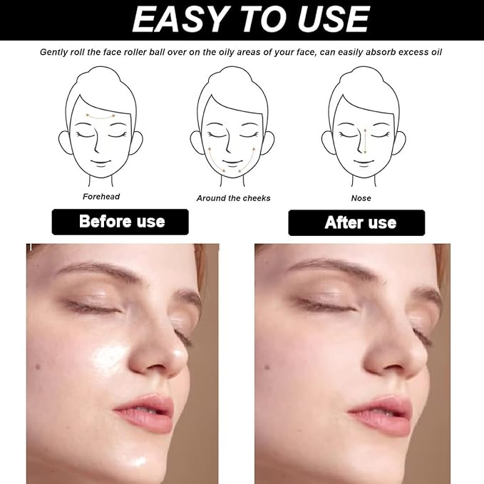 2Pcs Volcanic Face Roller Oil Control On The Face