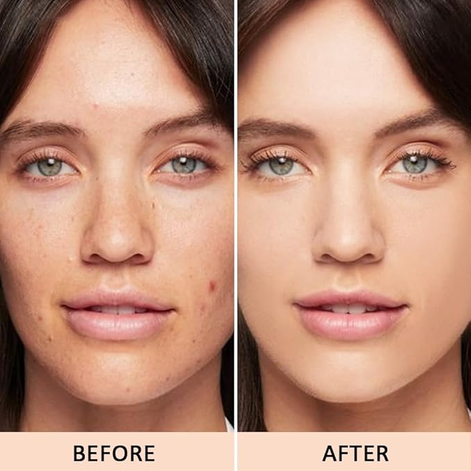 5 Colors Magic Touch Correcting Concealer Palette for 1 Count)