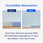 Moist Moment Under Eye Patches | Hydrating Eye Treatment Gel Masks With Hyaluronic acid & Squalane | Under Eye Masks For Dark Circles and Puffiness, Under Eye Bags, Wrinkle Care, Men and Women