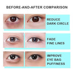 Snail Peptide Eye Cream, Snail Mucin Eye Cream Contains Niacinamide, Hyaluronic Acid To Reduce Wrinkles, Dark Circles, Puffiness and Fine Lines 17 ML