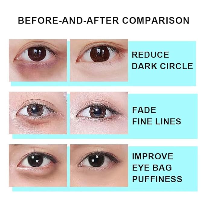 Snail Peptide Eye Cream, Snail Mucin Eye Cream Contains Niacinamide, Hyaluronic Acid To Reduce Wrinkles, Dark Circles, Puffiness and Fine Lines 17 ML