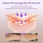 Aloe Vera Gel Soothes Skin for After IPL Laser Hair Removal Women Men in Face or Body, Travel Aloe Vera Gel for Sunburn Relief, Hydrate and Moisturize, Chamomile Extracts, 4.1 fl oz