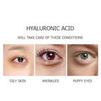 VENZEN Advanced Elastic Delicate Pearl Eye Essence Eyes Blooming Moving Smooth Moisturizing Massaging Tool