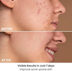 AMIRO Spectra 5-in-1 Light Therapy Face Mask, Contour With Blue, Red, Green, Yellow, and Infrared Light, 3 Modes for Oily, Acne-Prone, and Sagging Skin, Skincare for Face, Silver