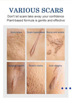 Advanced Scar Cream Gel, Scar Removal