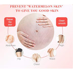 AICHUN BEAUTY Pregnancy Cream Streach Mark Remover Scars Repair Cellulites Lotion Cream 150ml