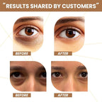 RAWLS 5% Caffeine Eye Serum and Under Eye Roller Cream for Dark Circles and Puffiness, Caffeine Eye Cream with 360° Massage Ball Reduce Wrinkles and Fine Lines-0.5 fl oz