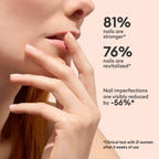 Manucurist Active Smooth 00 Nail Concealer Polish & Care - 2 in 1 Nude Nail Polish : Nail Strengthener and Growth - No Lamp - Ridge Filler for Nails - Natural Rosé Nail Polish