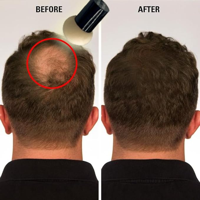 KERATIN RESEARCH Hairline Filler Unisex