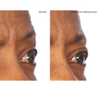 Sio beauty superlift forehead, eye,