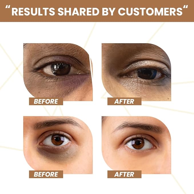 RAWLS 5% Caffeine Eye Serum and Under Eye Roller Cream for Dark Circles and Puffiness, Caffeine Eye Cream with 360° Massage Ball Reduce Wrinkles and Fine Lines-0.5 fl oz