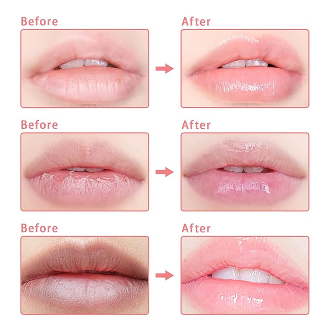 3 Pcs Bee Lip Balm Honey Pot, Coconut Watermelon Apple Lime Lip Mask Overnight, Moisturizing Lip Sleeping Mask, Hydrate Repair Prevent Dry Cracked Lip Exfoliator (Coconut +Watermelon+Apple Lime)