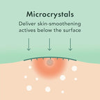 Rael Pimple Patches, Invisible & Microcrystal Spot Cover - Hydrocolloid Acne Patch for Face, Zit and Blemish, Breakouts, Vegan, Korean Skin Care (33 Count)