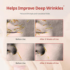 Dermatory pro vita-a retinal under