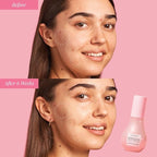 Glow Recipe Niacinamide Dew Drops Face Serum - Highlighting () 15ml