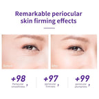 LANBENA Under Eye Cream, Retinol Eye Cream for Dark Circles and Puffiness, Daily Anti-Aging Under Eye Cream with Retinol & Hyaluronic Acid to Fight Fine Lines and Firm Skin (0.68 FL OZ)