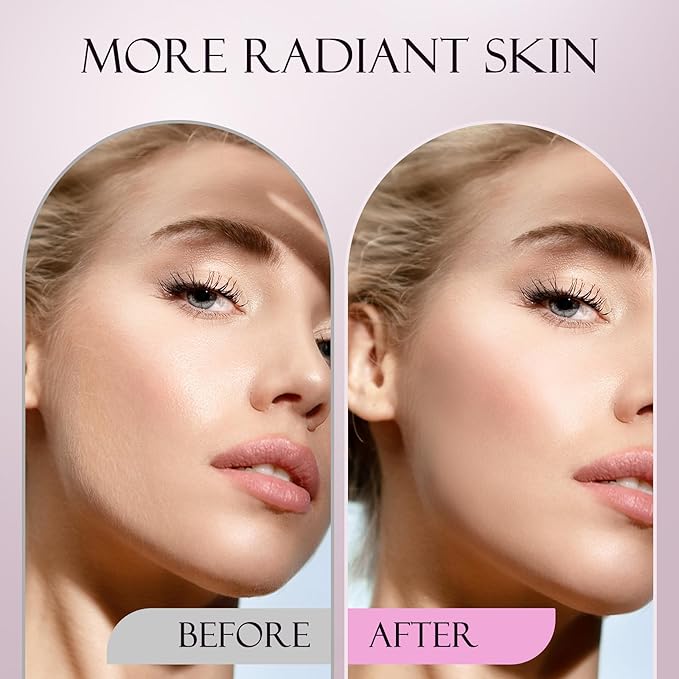 Sonic Dermaplane Razor for Women Face, Dermaplaning Tool for Face, Sonic Edge Technology, Facial Hair Removal for Women, Peach Fuzz with 8 Replaceable Blades(Pink)