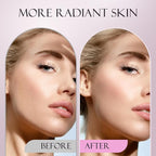 Sonic Dermaplane Razor for Women Face, Dermaplaning Tool for Face, Sonic Edge Technology, Facial Hair Removal for Women, Peach Fuzz with 8 Replaceable Blades(White)