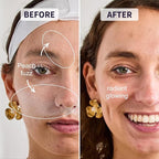 Face Razors for Women, Reusable Handle with 19 Microblades, Dermaplane Razor for Women Face, Eyebrow & Facial Razors, Peach Fuzz Remover, Gentle Exfoliating, for Sensitive Skin (Wisteria)